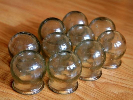 Продам медицинские стеклянные массажные  баночки.Советские,новые.22 шт