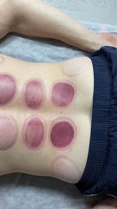 Массаж mед для тела