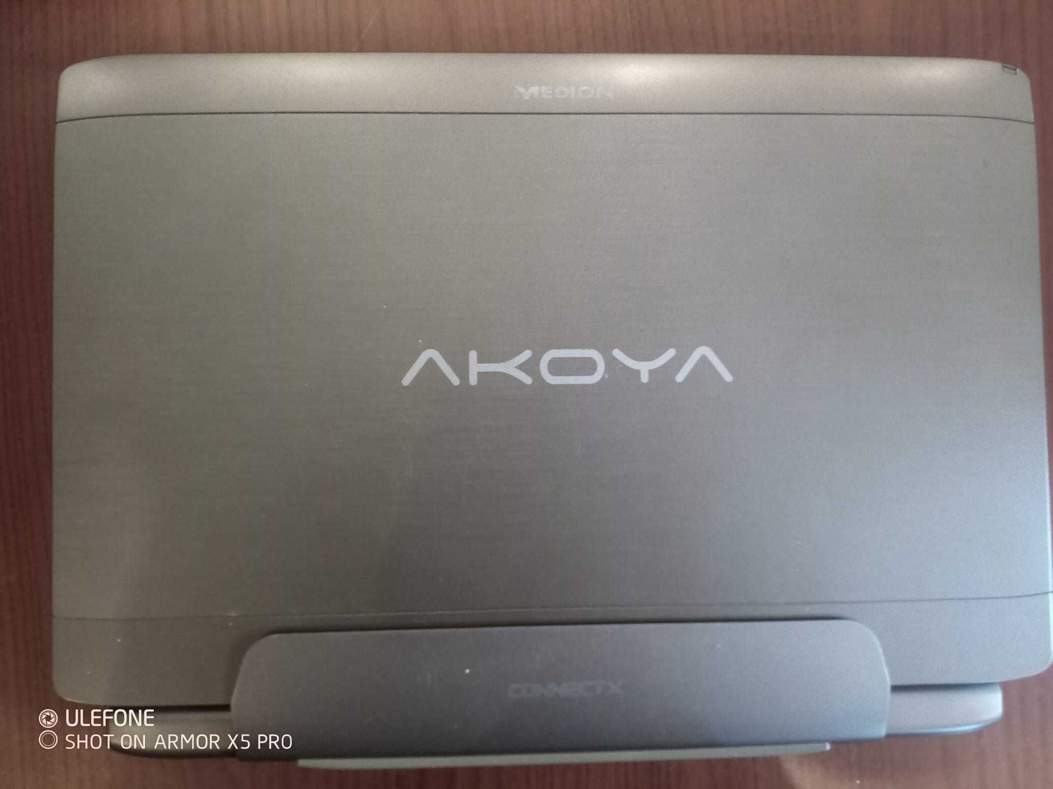 Vand laptop MEDION AKOYA Touchpad pret 430 lei