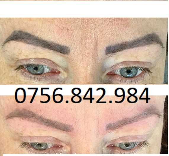 Arad-Eliminare tatuaj cu laser, preturi de la 100 ron