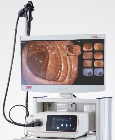 Full HD Эндоскопическая система IMAGINA, PENTAX Medical, Япония