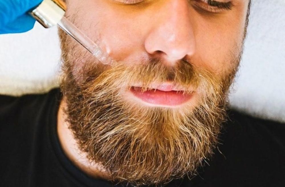 Minoxidil Kirkland 5% + Dermaroller