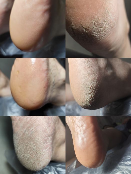 Маникюр,аппаратный педикюр у себя на дому