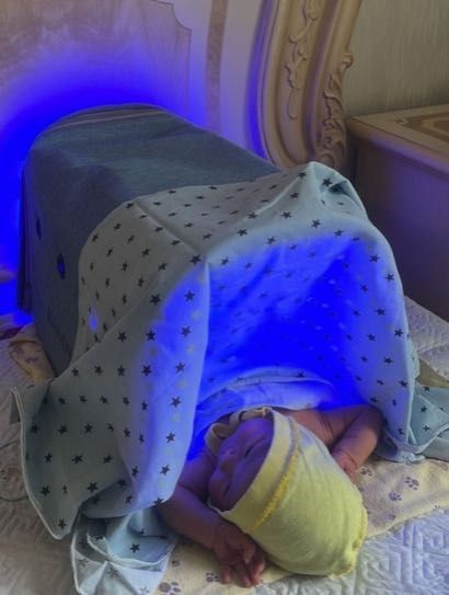 лампа от желтухи