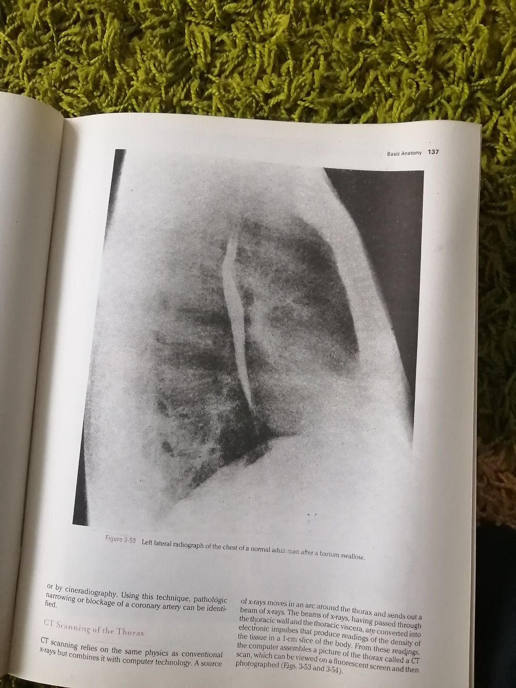 Clinical Anatomy by Regions, carte in limba engleza