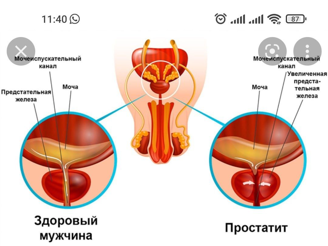 лечебный массаж для мужчин, женщин и детям