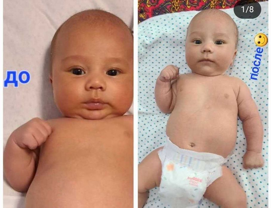 Fotolampa fototerapiya ot jeltuxi v arendu na dom