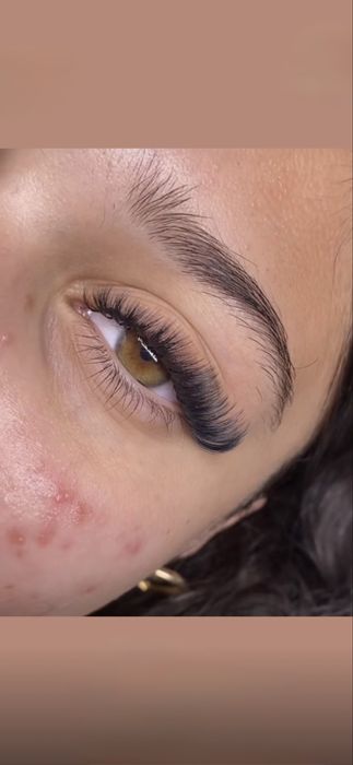 Aplic extensii de gene