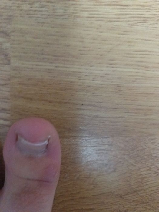 Deget matre de picior