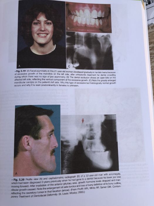 Contemporary Orthodontics,William R. Proffit,6th edition 2019