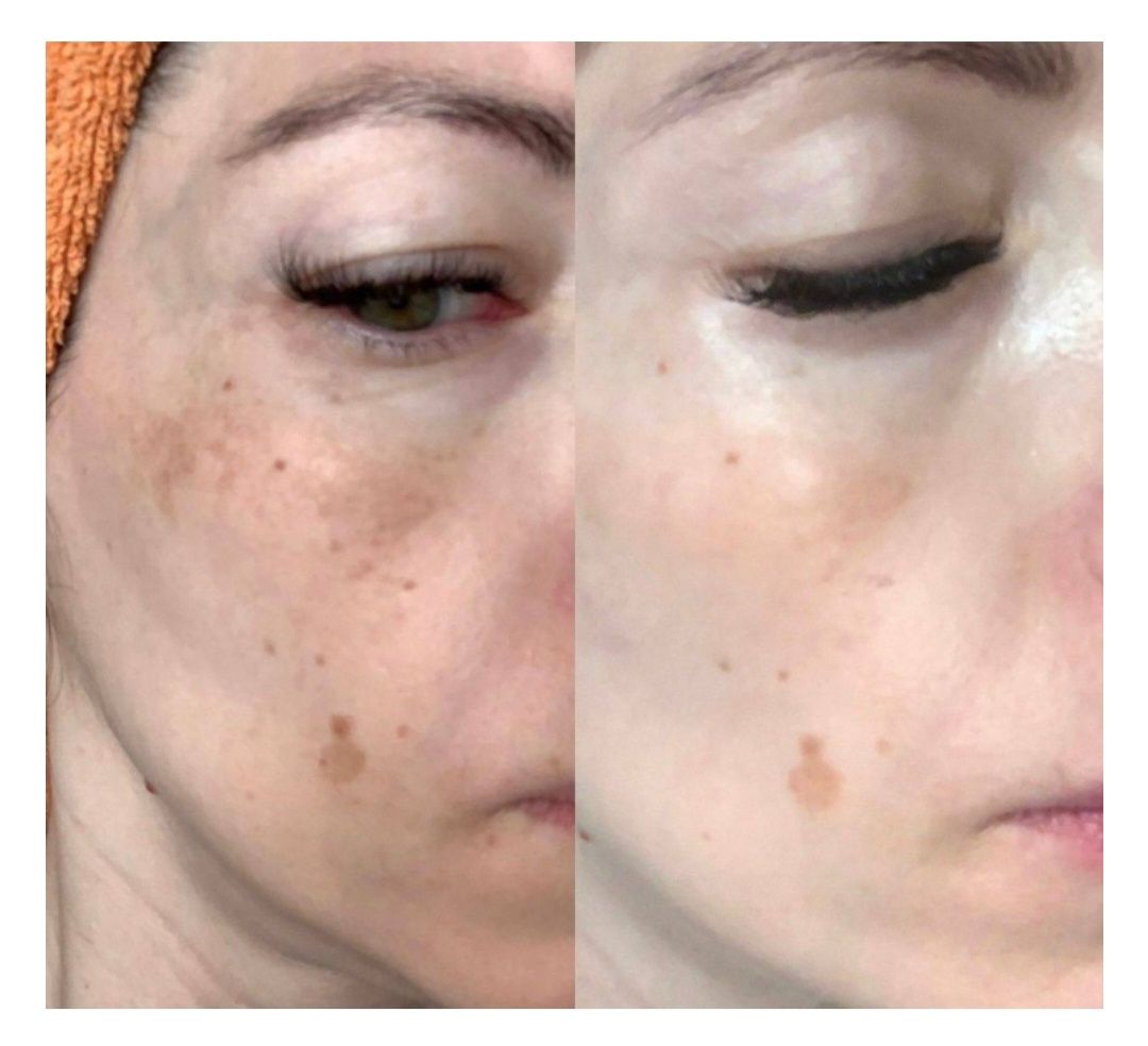 Stop pigment крем против пигментации