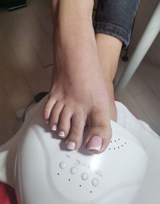 Unghi semipermanente