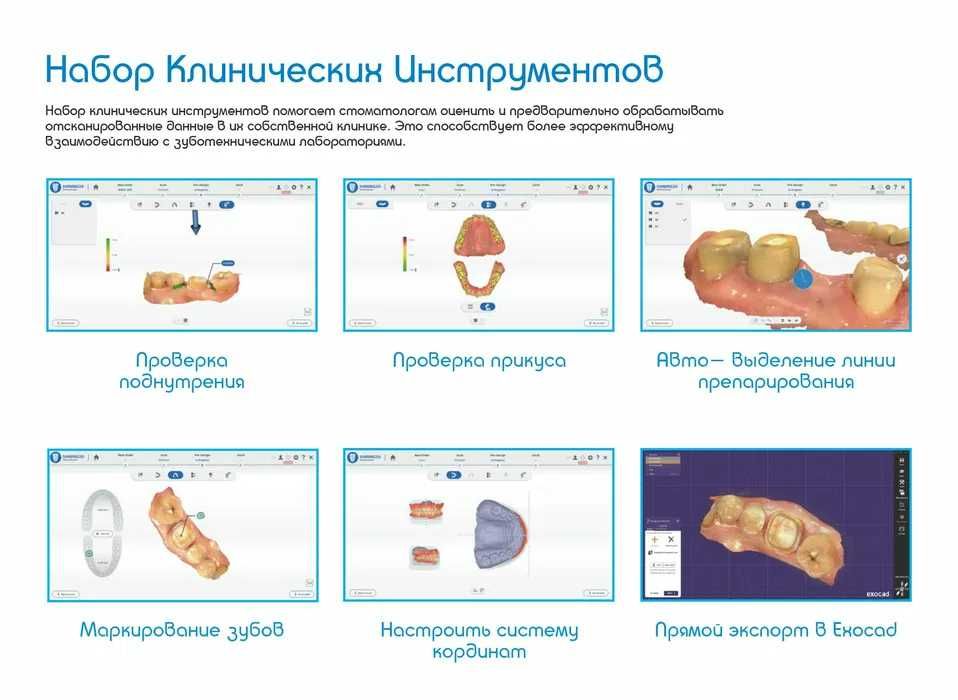 3D сканер. Интраоральный, стоматологический. SHINING3D Aoralscan 3,