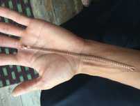 Tilla bilak braslet