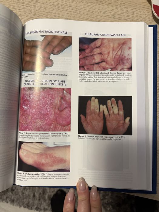 Manualul Merck editatia 20