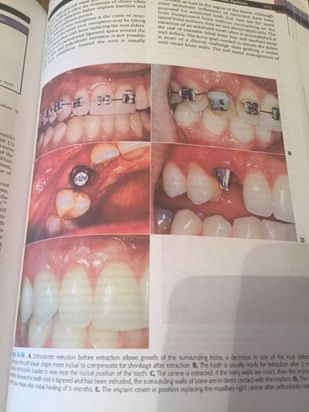 Contemporary Implant Dentistry - CARL E. MISCH, EDITIA 3 - 2009