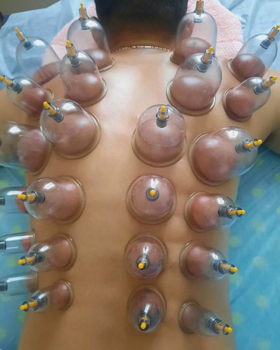 Лечебный баночный массаж: физ. нагрузки, спорт, простудные заболевания