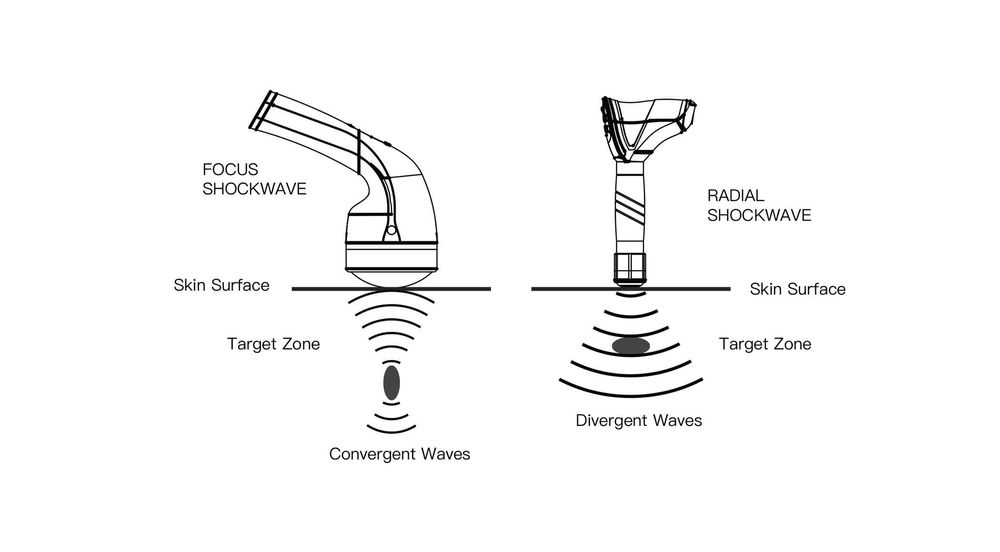 Фокусиран шокуейв AresPro EMFOCUS PRO