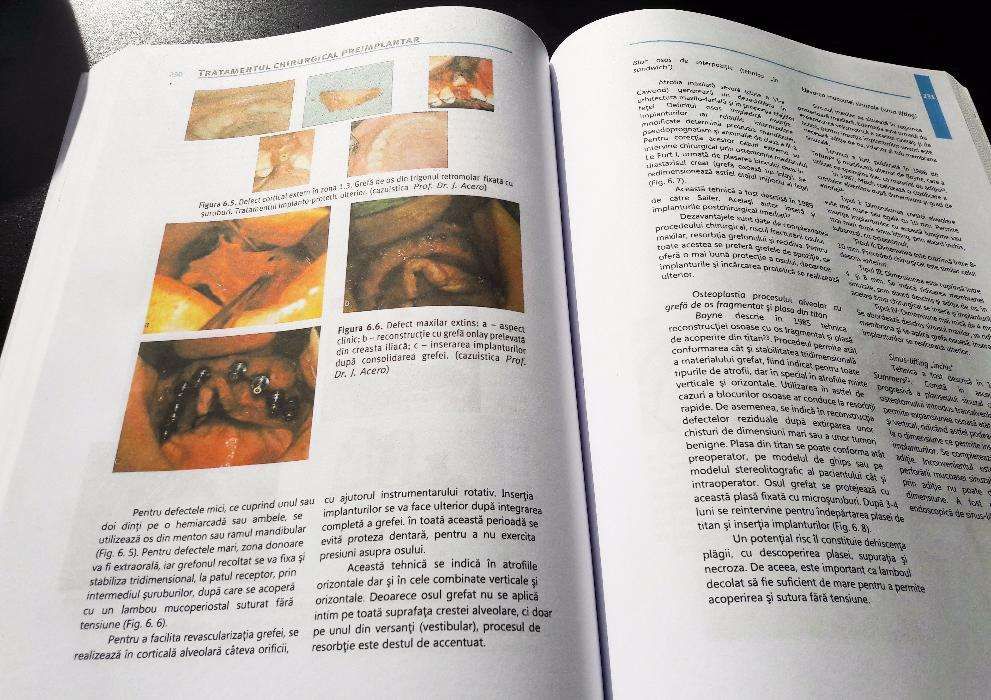 Compendiu de chirurgie Oro-maxilo-faciala de Alexandru Bucur Vol. 2