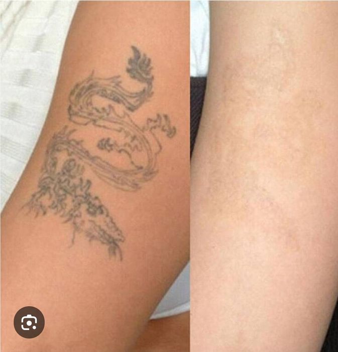 Татуировка учириш