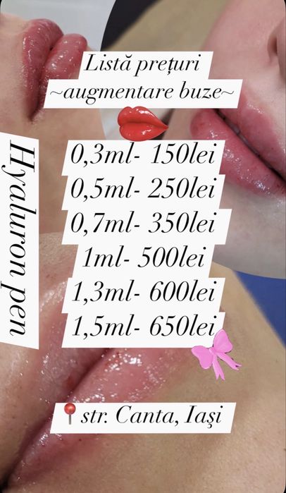 Augmentare buze cu acid hialuronic, lipoliza si epilare cu ceara