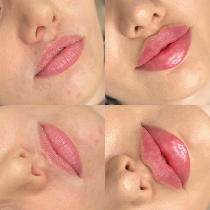 Lab shaklini to'g'rilash va kattalashtirish