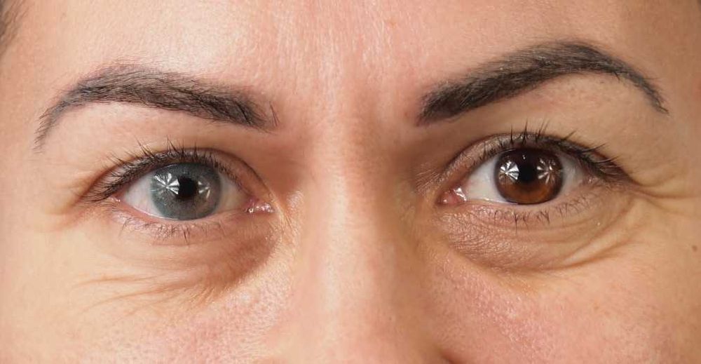 Maldives - lentile de contact colorate anuale, pachet complet