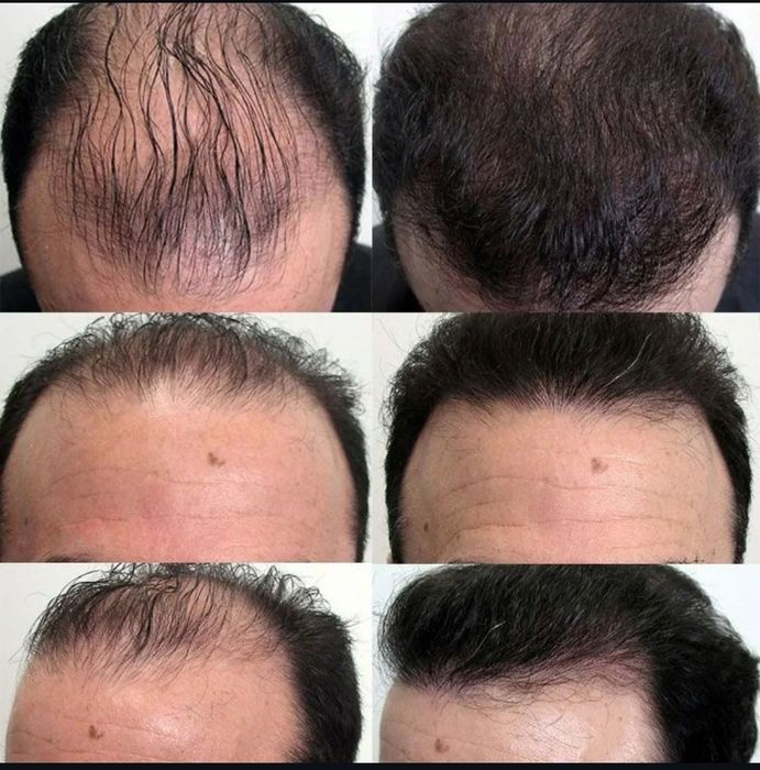 Erkaklarga ham ayollarga ham birdak tushadigan foydali natural sprey