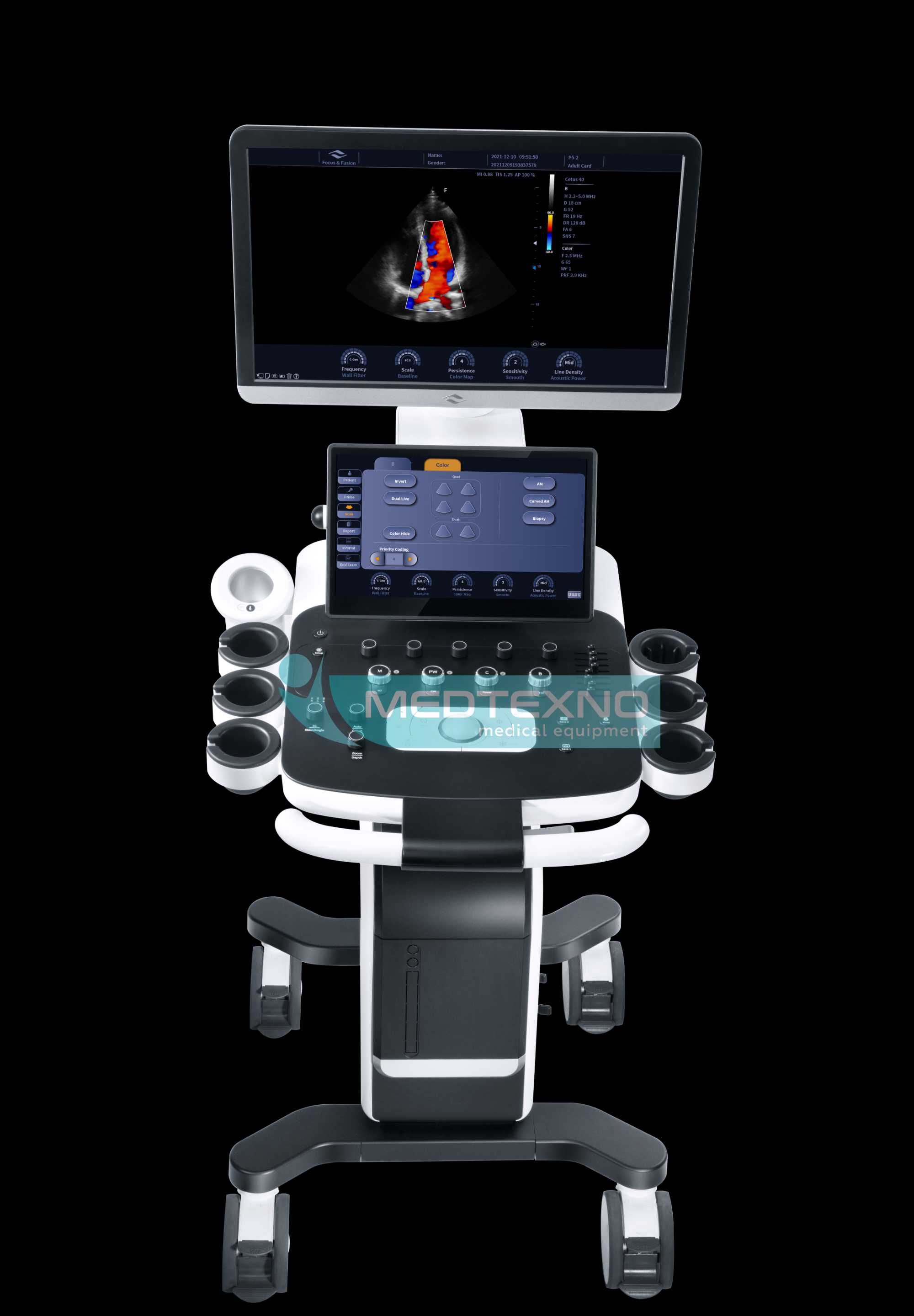 Cetus 40 – УЗИ аппарат с доплер системой с 3D/4D и объёмным датчиком