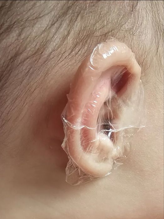 Водоустойчиви еднократни лепенки за уши за деца