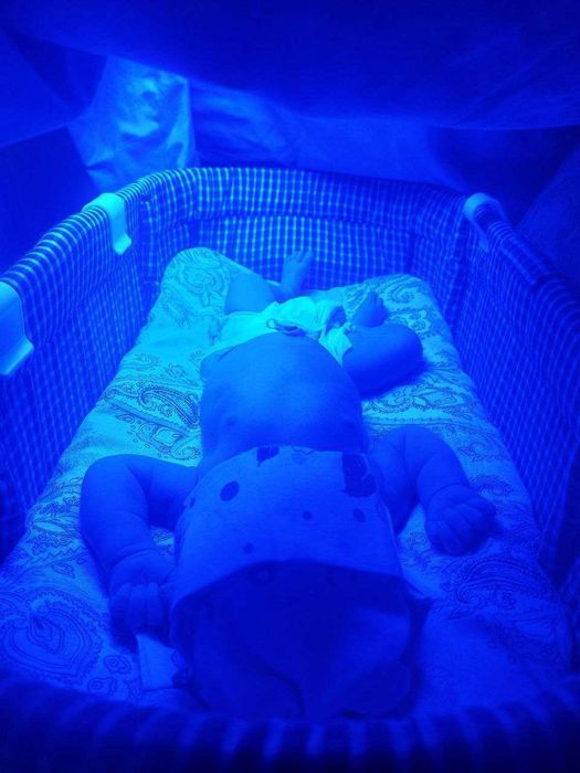 Fotolampa - chaqaloq sariqligi uchun ideal tanlov