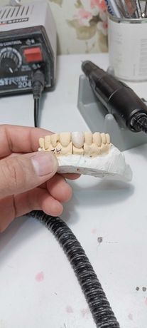 Протезирване зубов, техник зубной