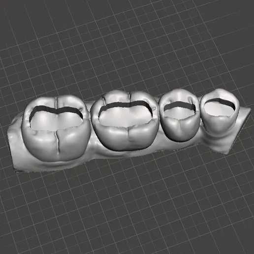 услуги CAD/FDM/DENTAL  Моделирования зубов