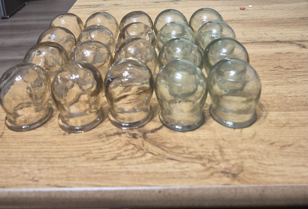 Банки  медицинские советских времён 20 штук