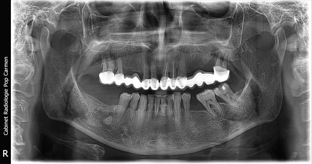 Aparatură radiologie dentară