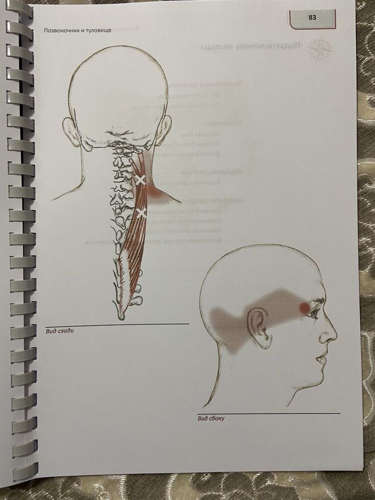 Клинический атлас триггерных точек