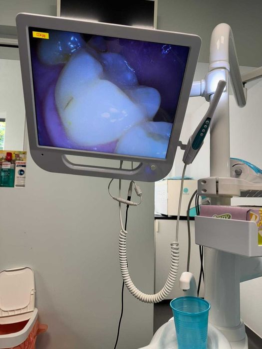 Camera intraorala cu monitor 17" si brat unit