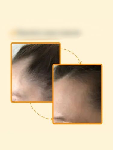 Средство для роста волос