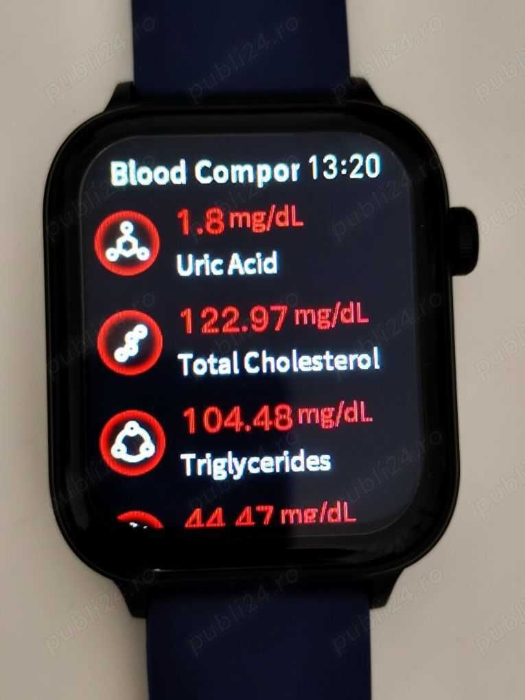 Smartwatch VALDUS nou cu măsurare glicemie, colesterol, acid uric, EKG