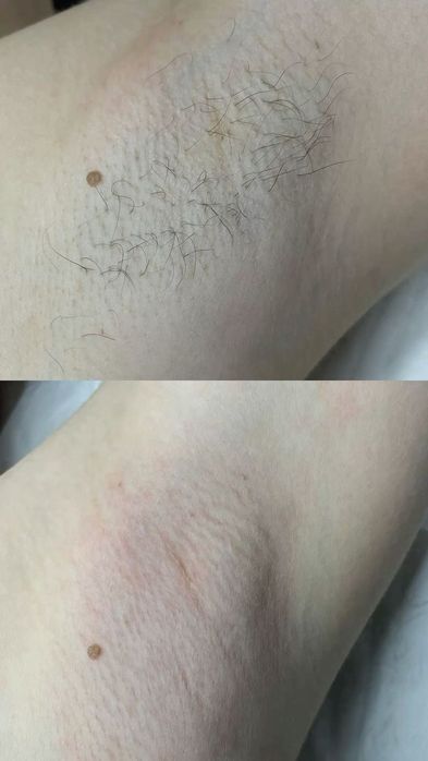 Депиляция только для женьщин. Ташкент