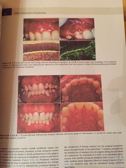CARRANZA's Clinical Periodontology 13th edition 2018