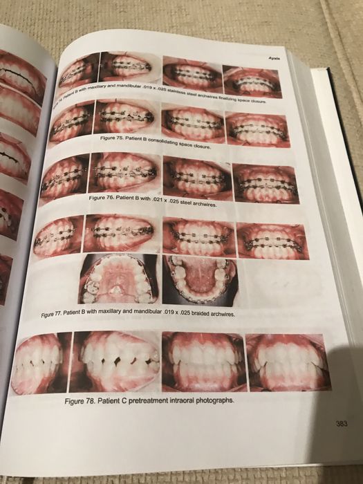 Goal-Directed ORTHOdontics 2013
