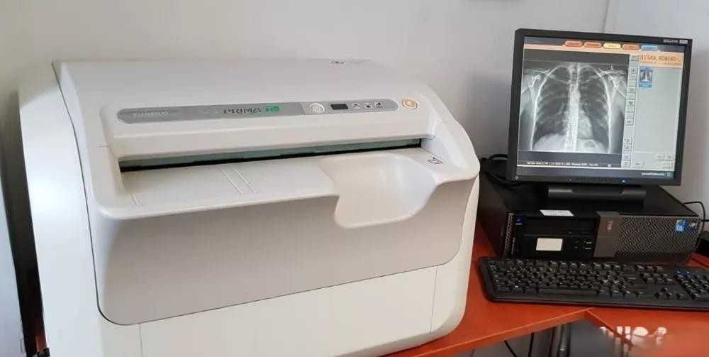 Vand developeza digitala pentru radiologie FUJI CR Prima T2