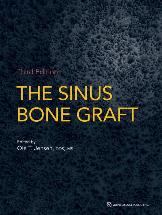 The Sinus Bone Graft - Ole T. Jensen 3rd Edition - 2019