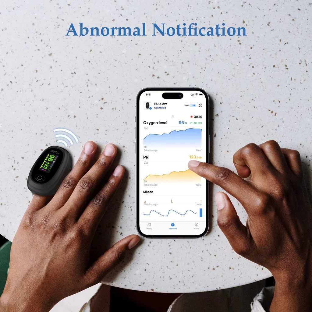 Пулсоксиметър с APP и Bluetooth