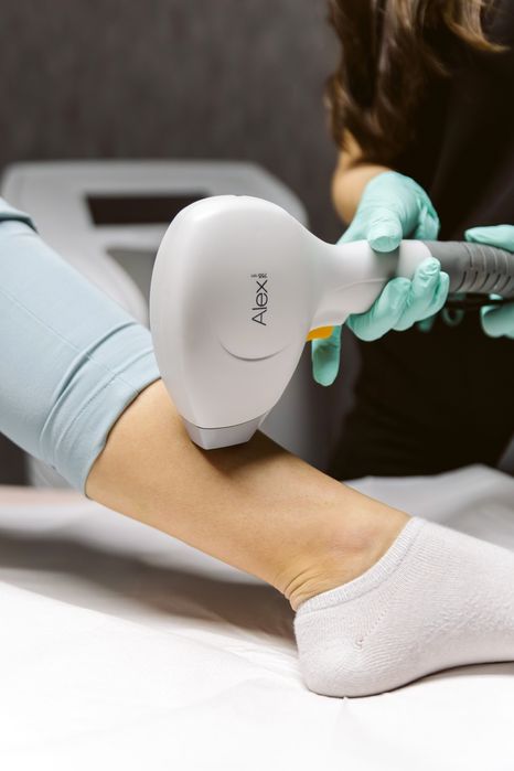 Vând PrimeLase HR Excellence, Laser Alexandrite