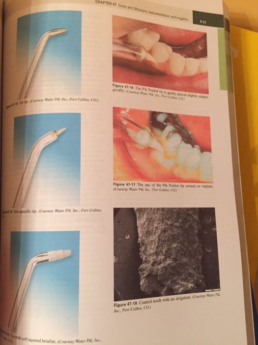 CARRANZA's Clinical Periodontology 13th edition 2018