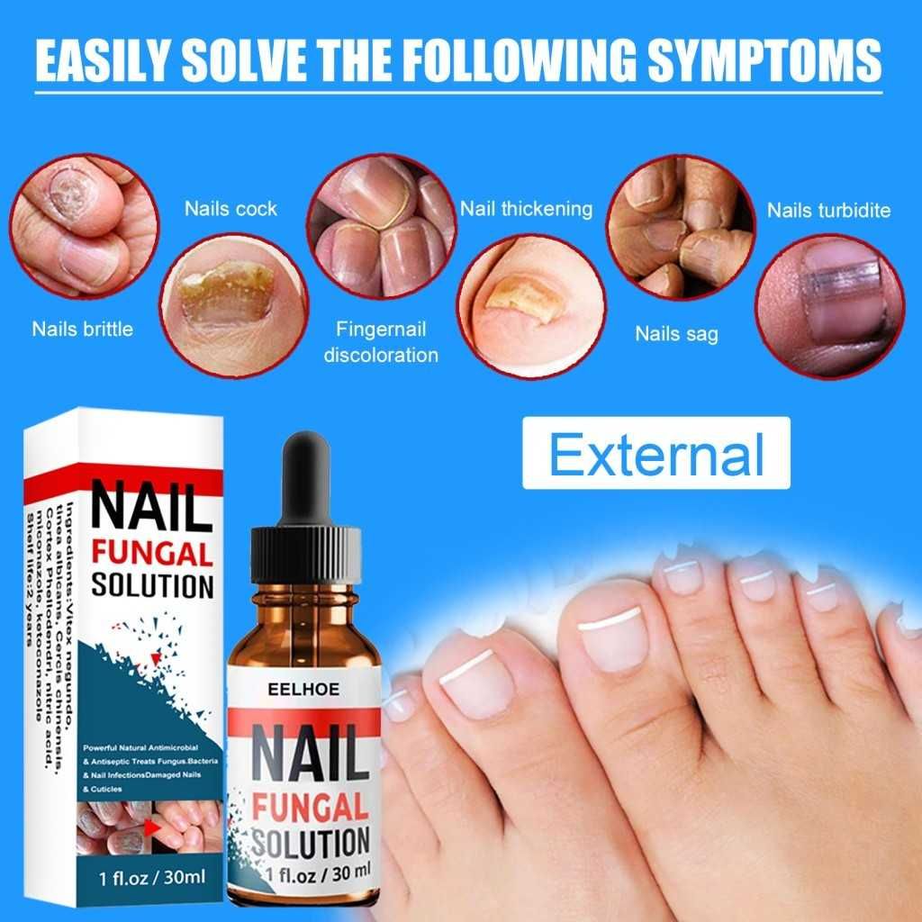Продукт за лечение на гъбички по ноктите Eelhoe 30 ml