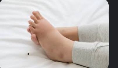 Сынықшы , Костоправ, Хиджама, Сыныкшы,