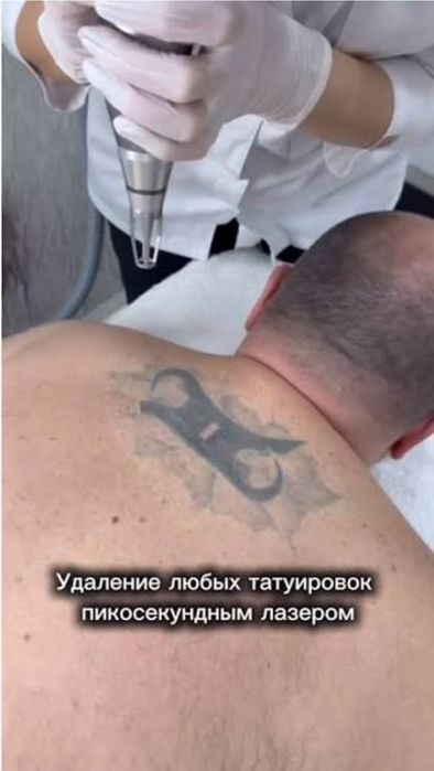 Лабиопластика,Броулифтинг,Блефаропластика.